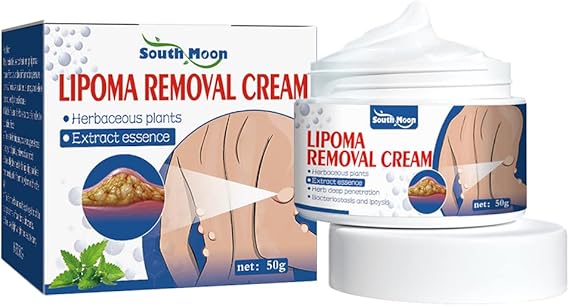 South Moon Lipoma Removal Cream || SUMMER SALE OFFER.